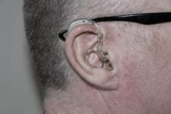 Hearing aid fitting ontop of the ear.
