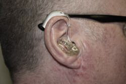 Hearing aid fitting in the ear.